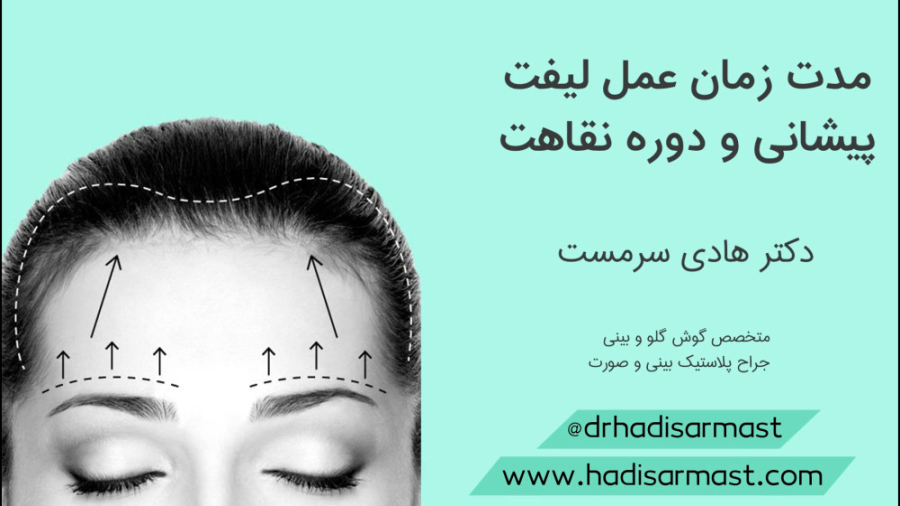 لیفت شقیقه (لیفت پیشانی) دکتر سرمست آزمایش شمارش رتیکولوسیت