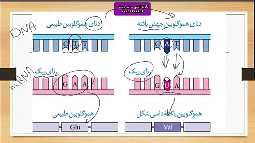 تدریس زیست دوازدهم "جهش هموگلوبین" پالپوتومی