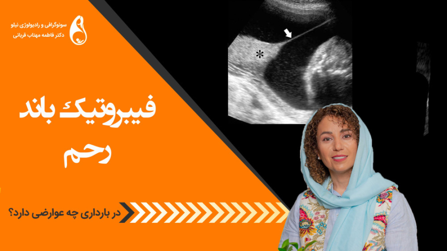 فیبروتیک باند در بارداری سونوگرافی نیلو دکتر فاطمه مهتاب قربانی