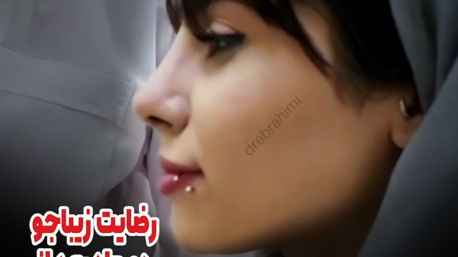 رضایتمندی زیباجو دوماه بعد از جراحی زیبایی بینی توسط بهترین جراح بینی تهران دکتر امید ابراهیمی