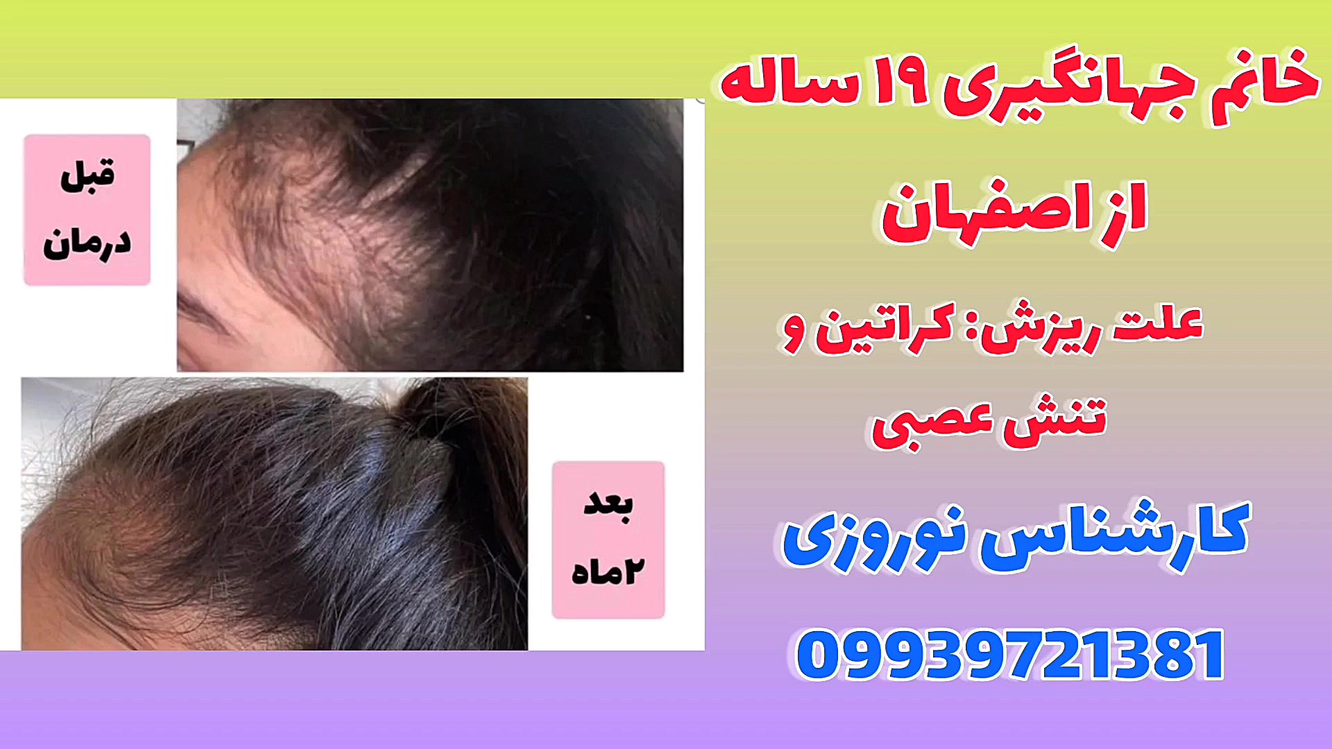 درمان خانگی ریرش مو عکس هنری