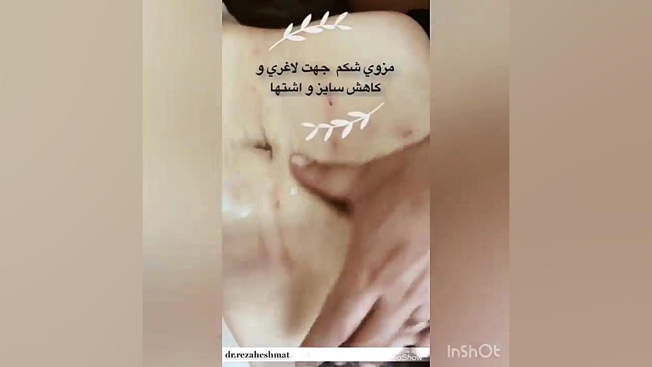 مزوتراپی شکم کلینیک لیزر