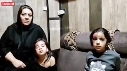 حمله سگ های ولگرد به دو دختربچه در کرمان حمله سگ های ولگرد به دو دختربچه در کرمان