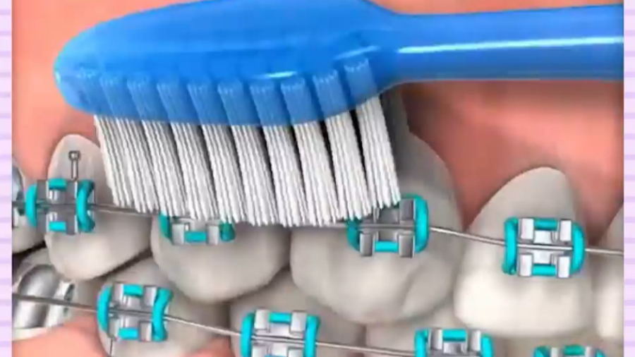 بهداشت ارتودنسی جراحی پف زیر چشم