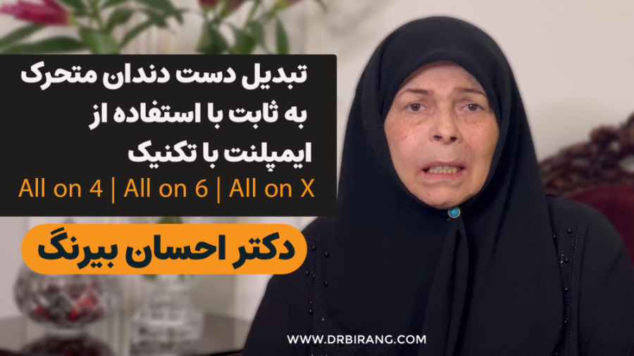 تبدیل دست دندان مصنوعی متحرک به ثابت با استفاده از تکنیک ایمپلنت all on 4 دکتر احسان بیرنگ