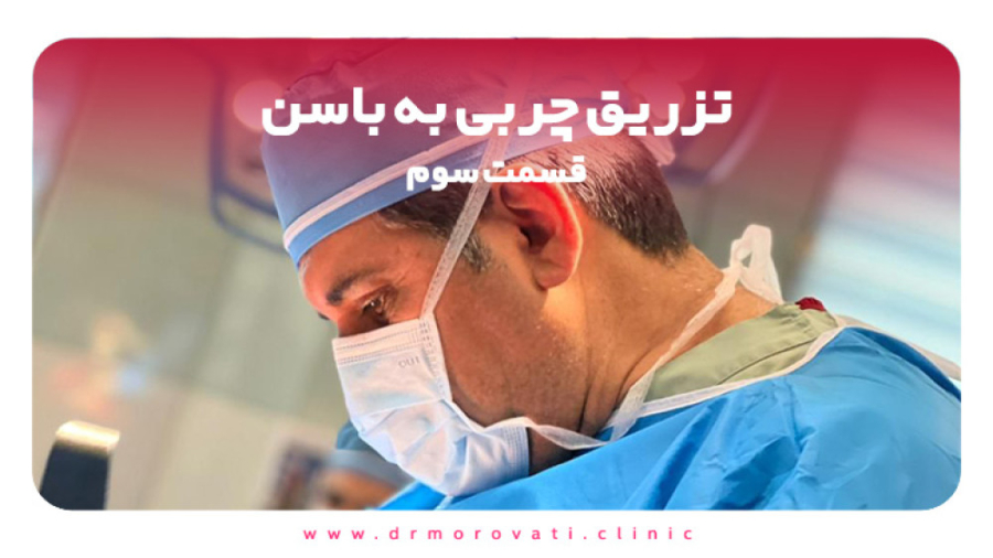 تزریق چربی به باسن | قسمت سوم لیزر کوانتومی جراحی چشم
