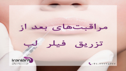 توصیه های بعد از تزریق فیلر لب توصیه های بعد از تزریق فیلر لب