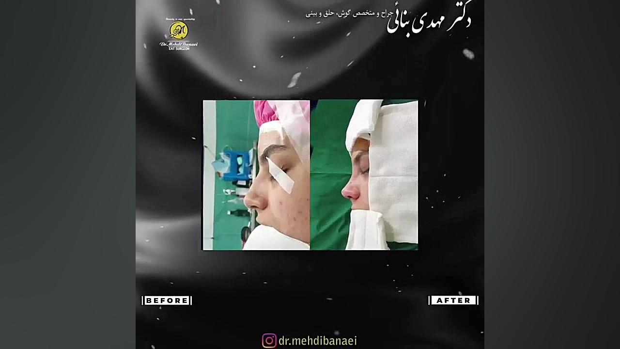 عمل بینی فانتزی