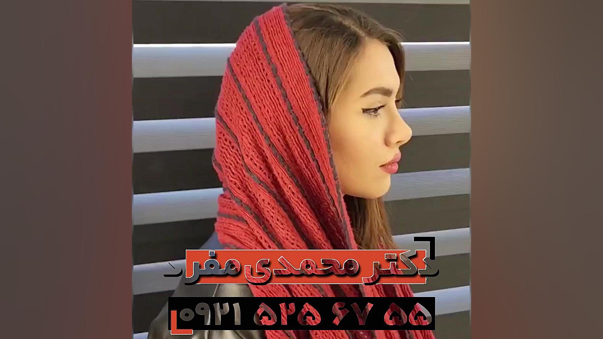 جراحی بینی دکتر امیر حسین محمدی مفرد بعد از ۲ سال دکتر امیر حسین محمدی مفرد