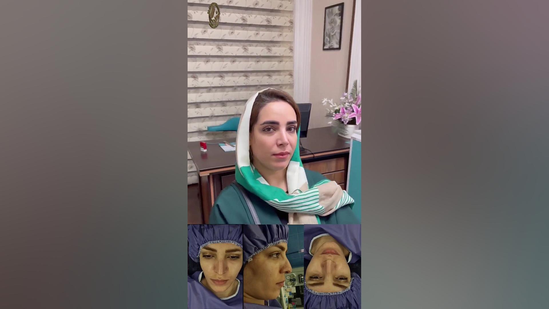 جراحی بینی توسط بهترین جراح بینی تهران دکتر امیرحسین محمدی مفرد دکتر امیر حسین محمدی مفرد