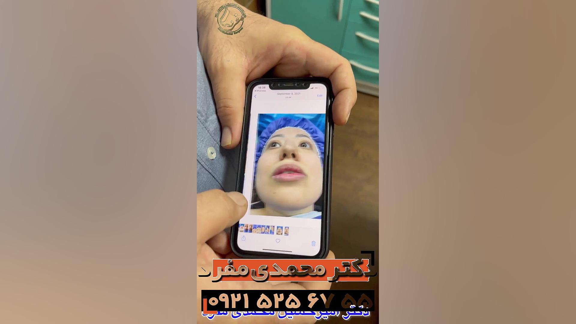 دکتر امیرحسین محمدی مفرد-جراحی بینی دکتر امیر حسین محمدی مفرد