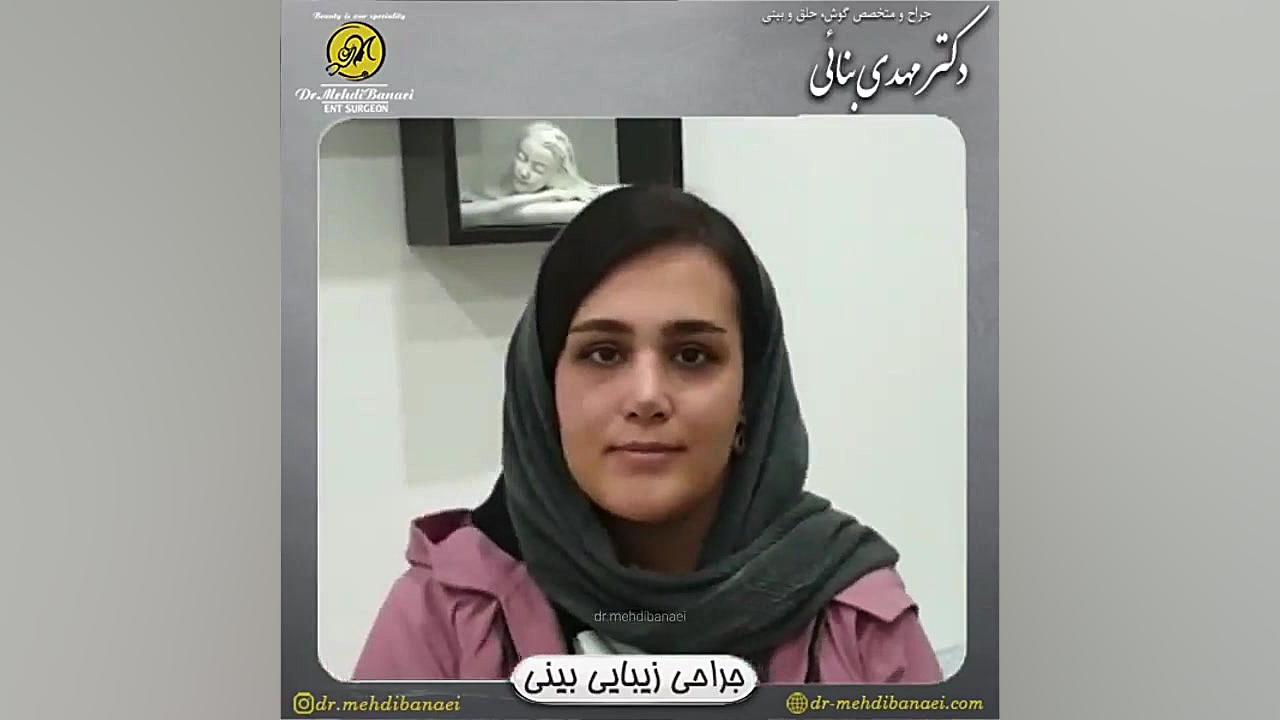 رضایت بیمار عزیز سه ماه پس از جراحی زیبایی بینی