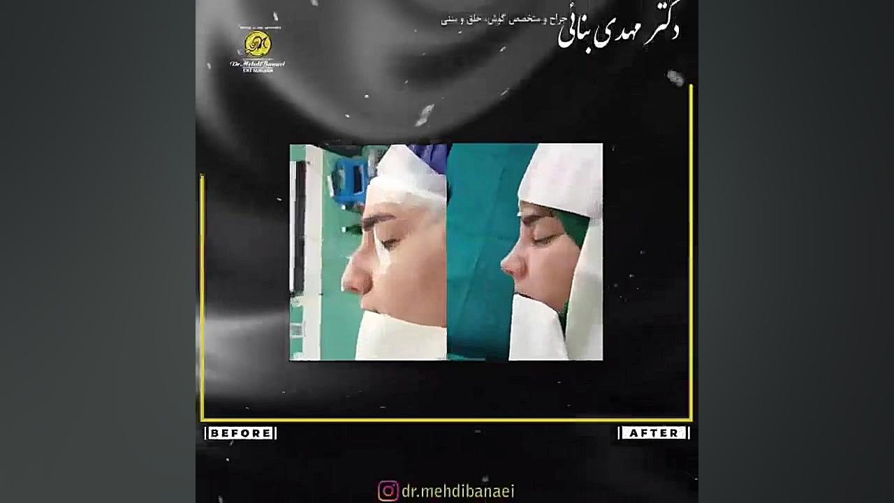 جراحی زیبایی بینی