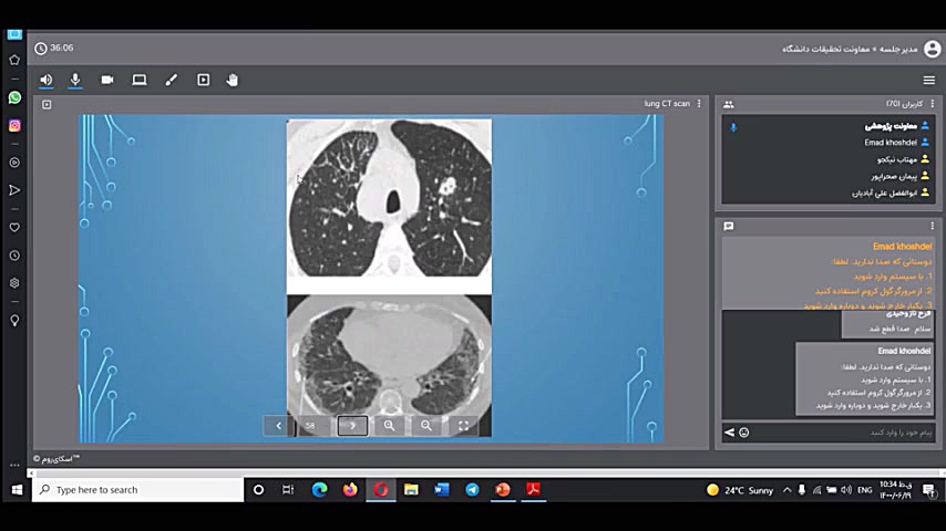 تفسیر رادیوگرافی و CT-Scan بیماری های ریوی (جلسه دو) لیزر صورت