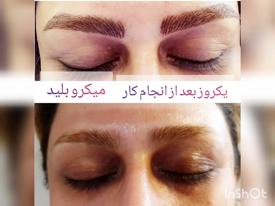 میکرو بلید