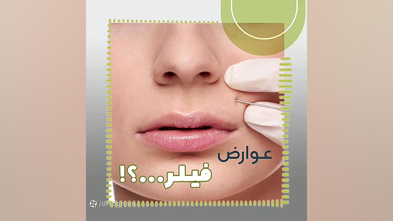 آیا تزریق فیلر عوارضی داره؟ دکتر ایمان روغنی جراح و متخصص پوست و مو