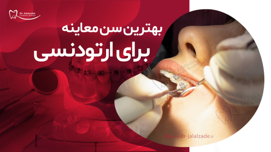بازه ی زمانی معاینات ارتودنسی دکتر مرضیه جلال زاده