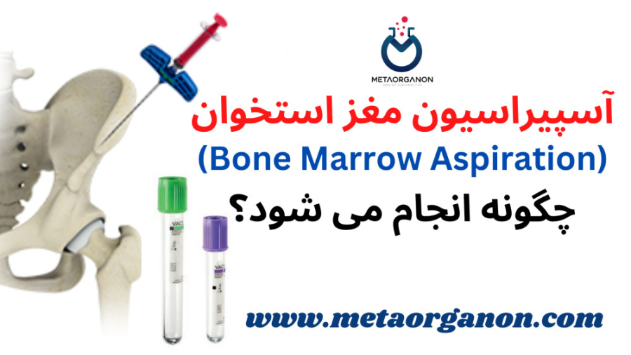 آسپیراسیون مغز استخوان چگونه انجام می شود؟ عمل زیبایی