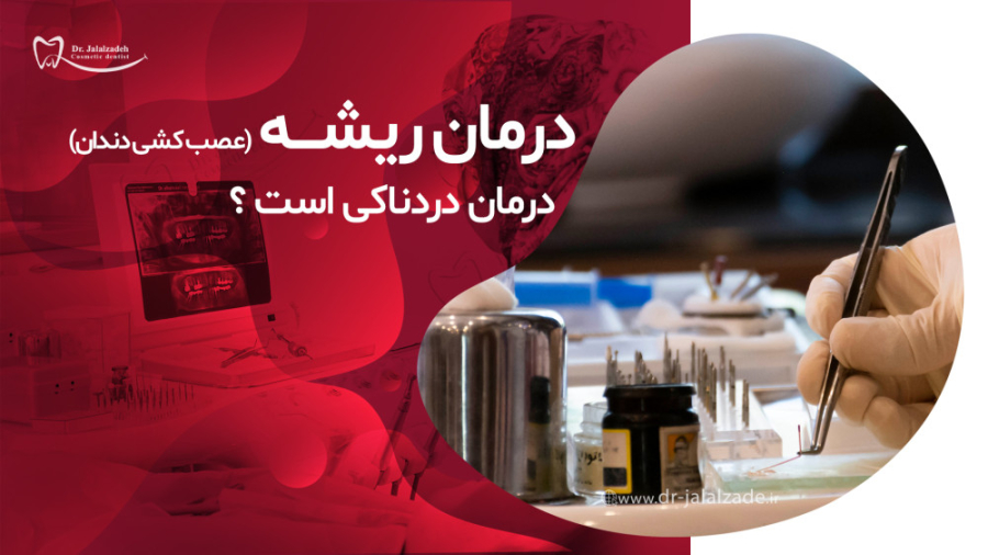 درد هنگام درمان ریشه یا عصب کشی دکتر مرضیه جلال زاده