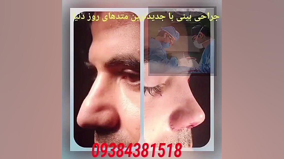 جراحی بینی دکتر محمد مهدی مهرابی جراح پلاستیک و زیبایی