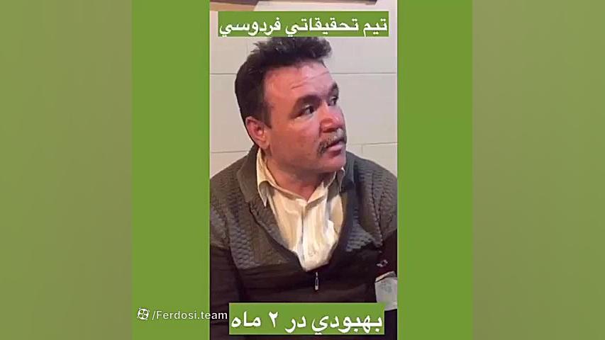 درمان پیسی و لکه های پوستی آکنه
