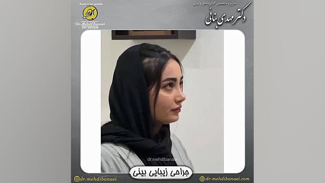 رضایت بیمار عزیز پس از جراحی زیبایی بینی