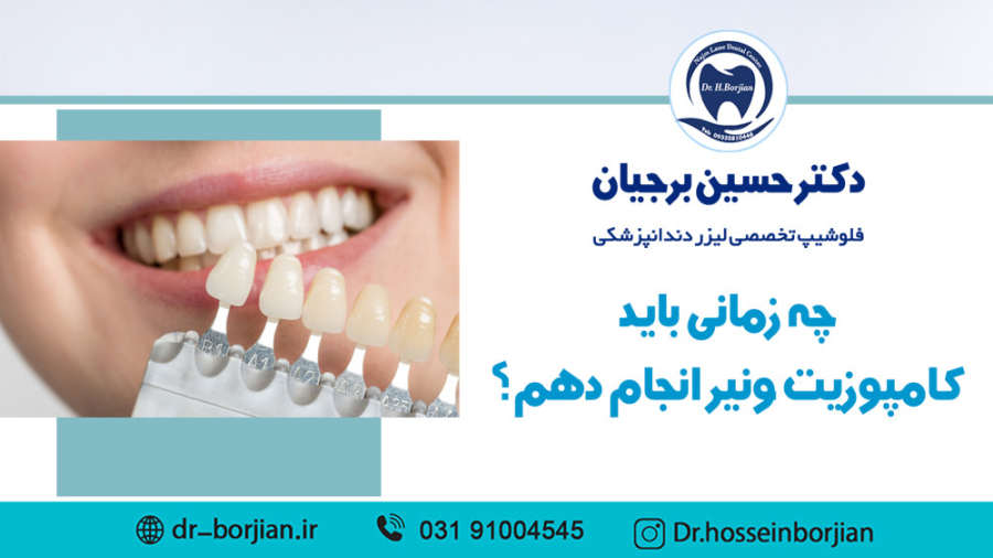 چه زمانی باید کامپوزیت ونیر انجام دهم؟| بهترین دندانپزشک زیبایی اصفهان جراحی بینی