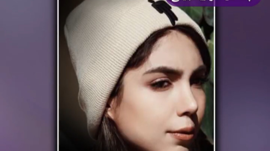 نمونه های عمل زیبایی بینی دکتر محمد ابراهیمی-فوق تخصص جراحی پلاستیک و زیبایی پزشکی زیرآب