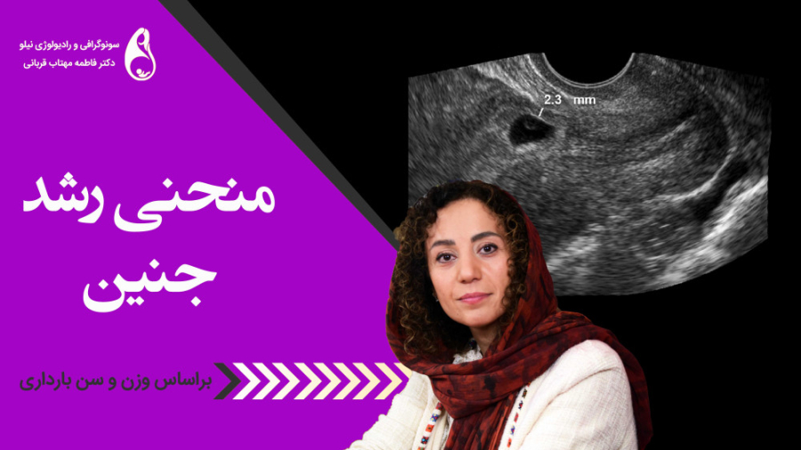 منحنی رشد جنین سونوگرافی نیلو دکتر فاطمه مهتاب قربانی