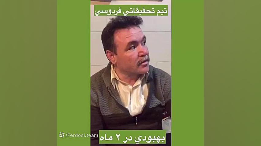 درمان پیسی و لکه های پوستی لمینت