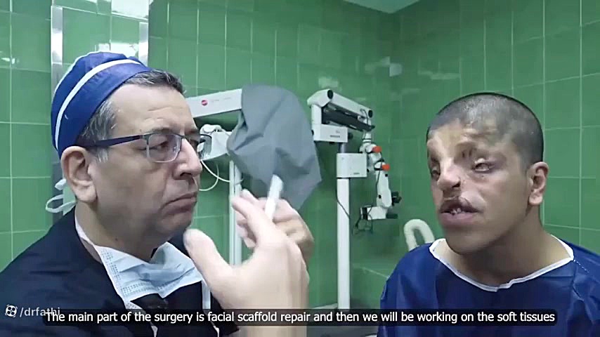 معجزه جراحی ترمیمی صورت دکتر حمید رضا فتحی فوق تخصص جراحی پلاستیک