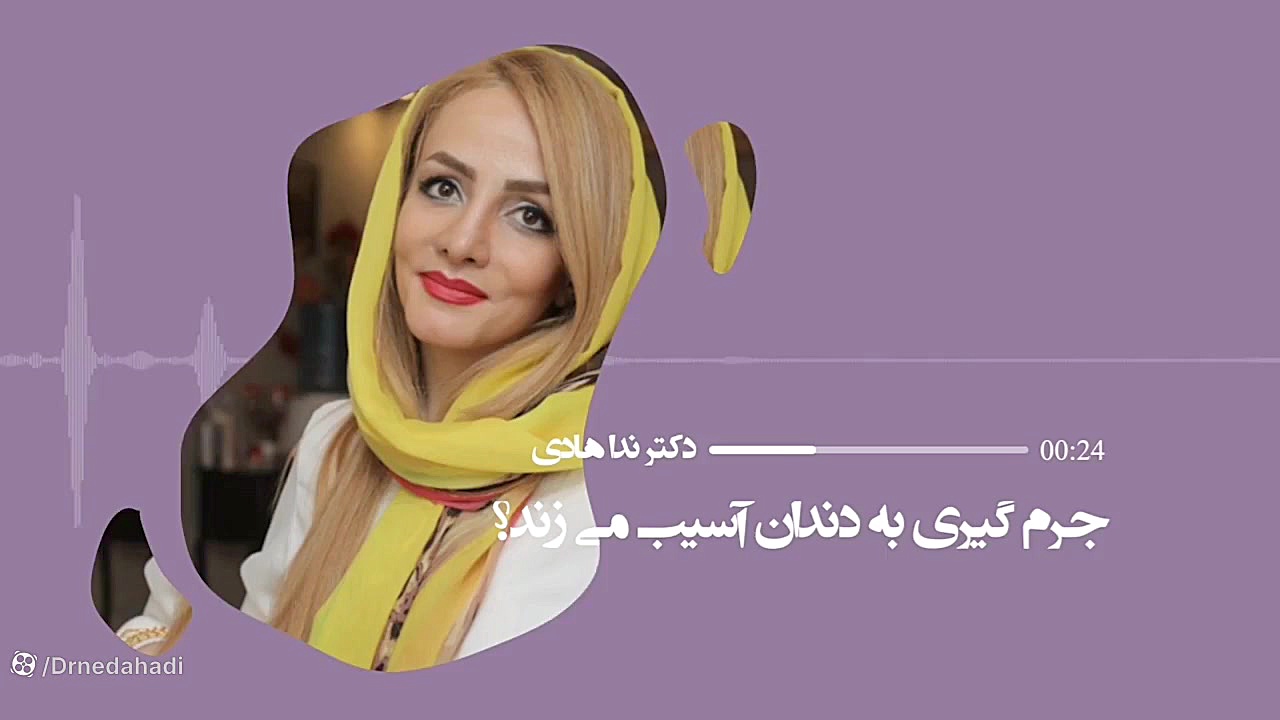 فیلم جذاب از اینکه شما هرچندوقت یکبار جرم گیری میکنید ؟ دکتر ندا هادی-دندانپزشک زیبایی