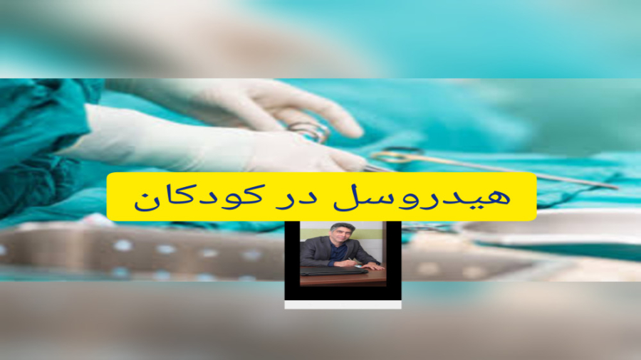 هیدروسل/آب آوردن کیسه بیضه درکودکان/ دکترخیام فرفوق تخصص اورولوژی کاشت مو