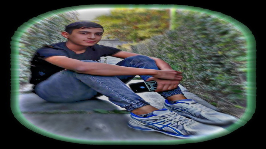 امیرحسین جلائیان ماموپلاستی