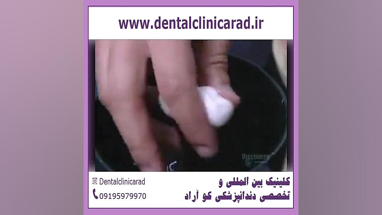 روش شستن دندان مصنوعی و سفید کردن آن بیماری سندروم آلاژیل
