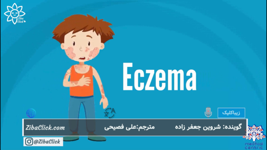 0 تا 100 اگزما: علائم، پیشگیری، درمان سریال