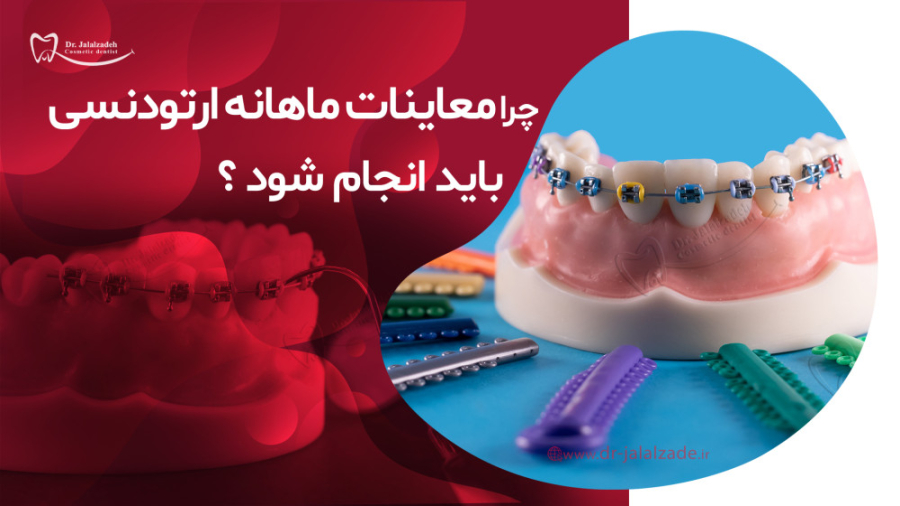 دلیل اهمیت معاینات ماهانه ارتودنسی چیست؟ دکتر مرضیه جلال زاده