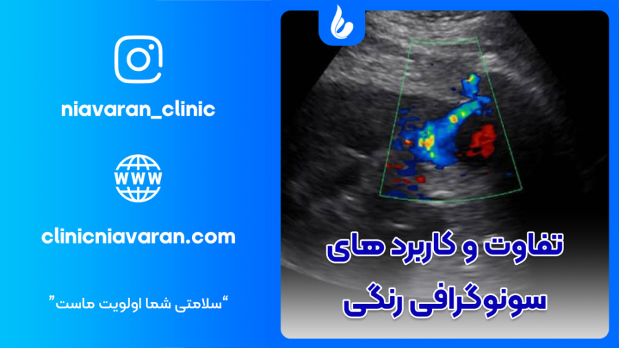 سونوگرافی رنگی لیفت پیشانی