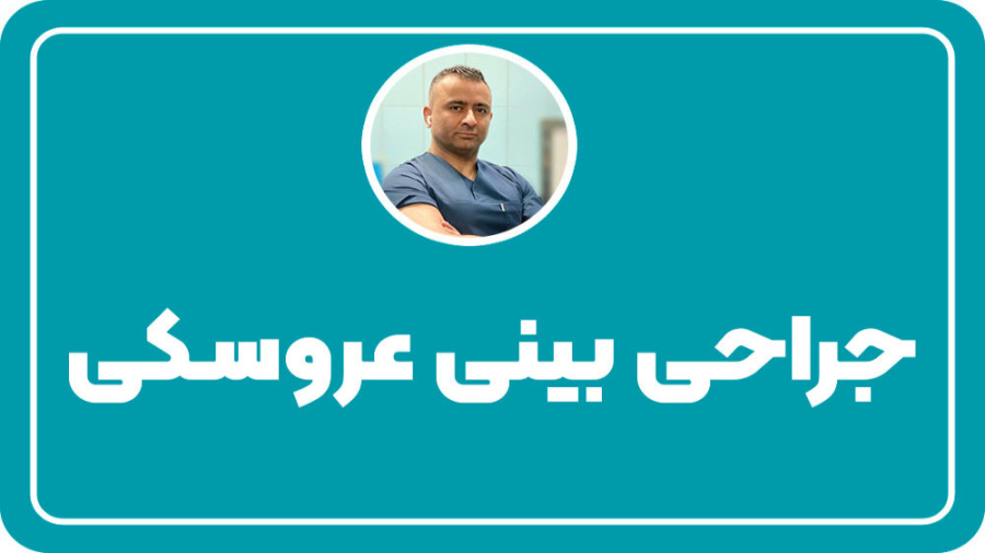 جراحی بینی عروسکی توسط دکتر ایزدپناه بیماری نوری آسیب ارثی