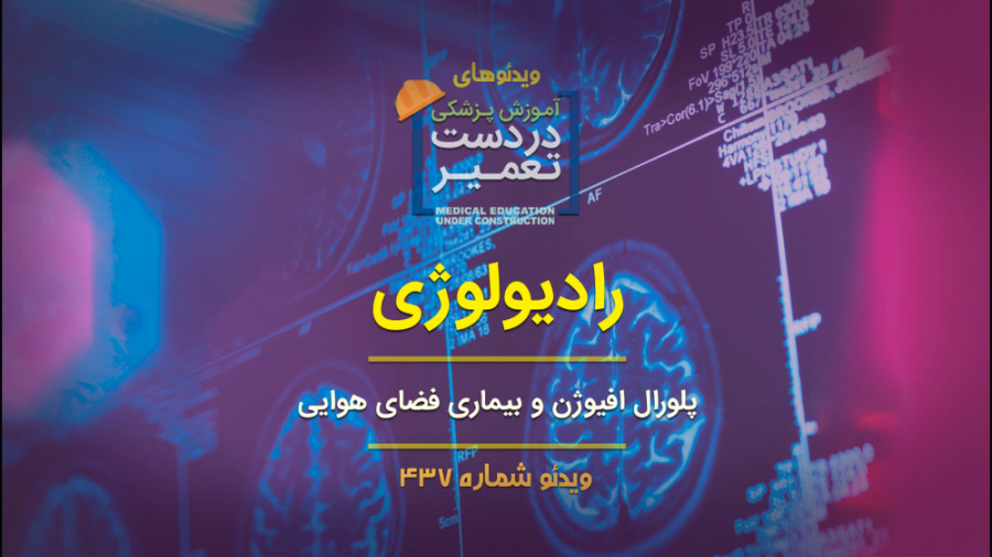 رادیولوژی (پلورال افیوژن و بیماری فضای هوایی) ماکروسفالی