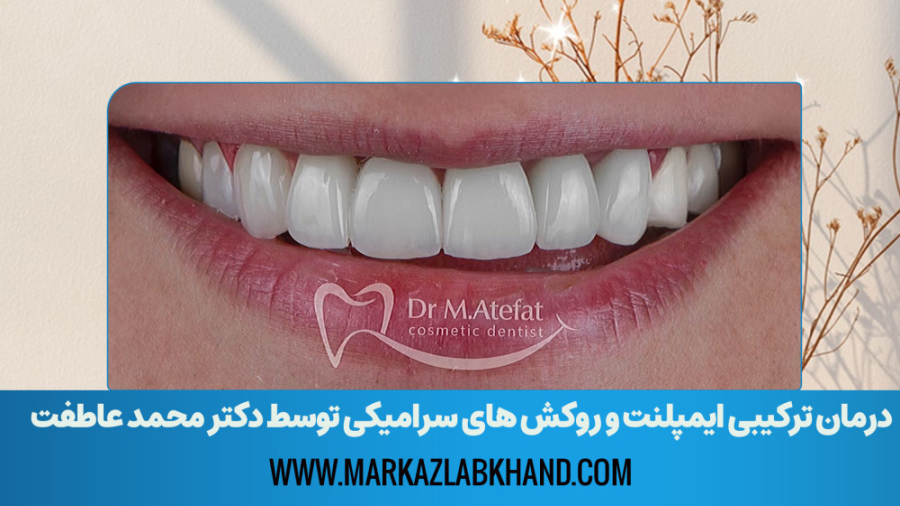 درمان ترکیبی ایمپلنت و روکش های سرامیکی توسط دکتر محمد عاطفت | اصفهان دکتر محمد عاطفت متخصص ترمیمی و زیبایی اصفهان