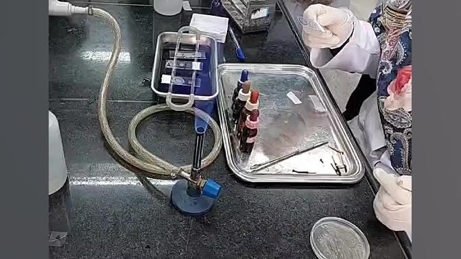 فیکس کردن لام در رنگ آمیزی بلیچینگ دندان