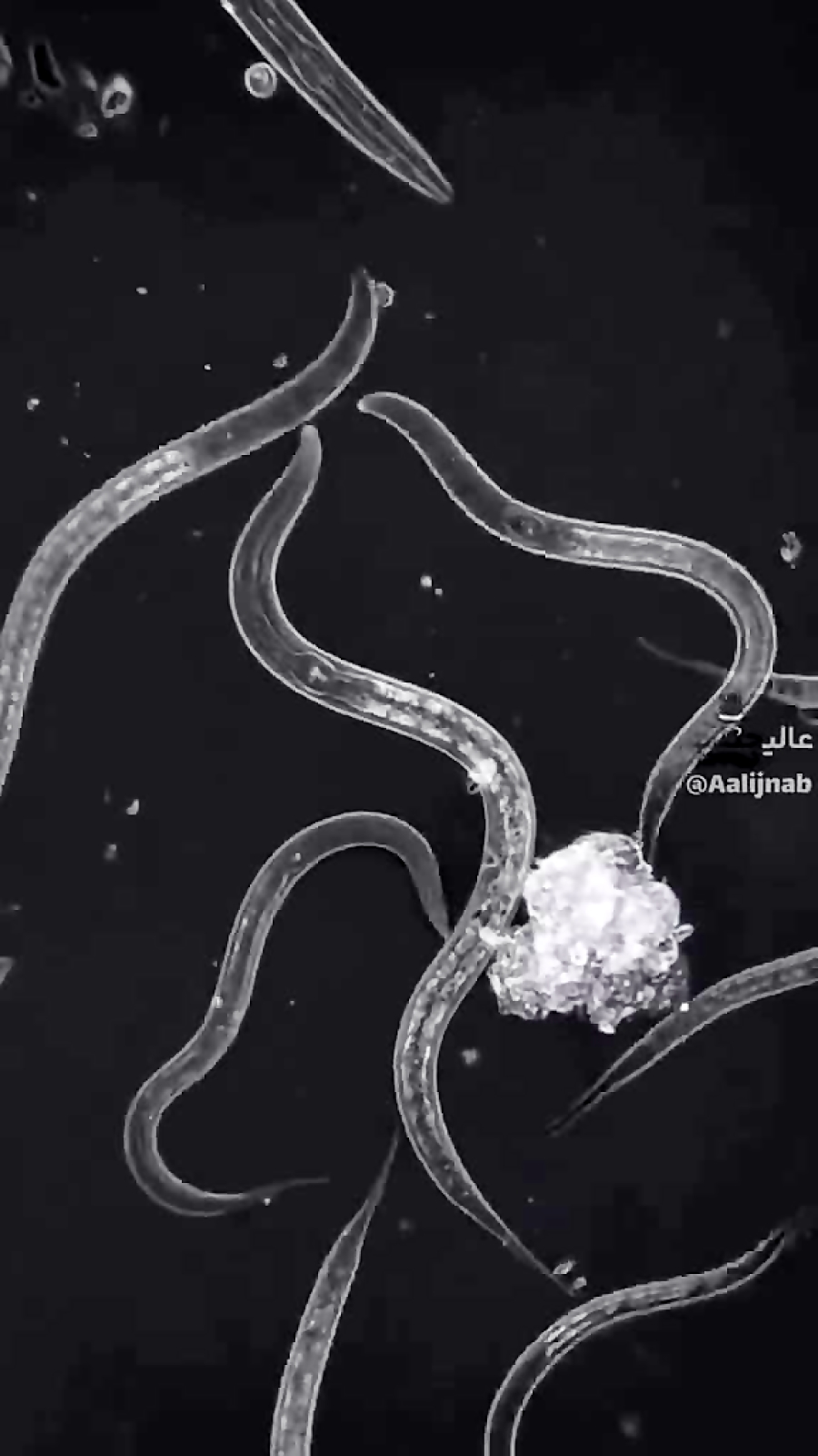 ببینید زیر ناخن چه ویروس های هست