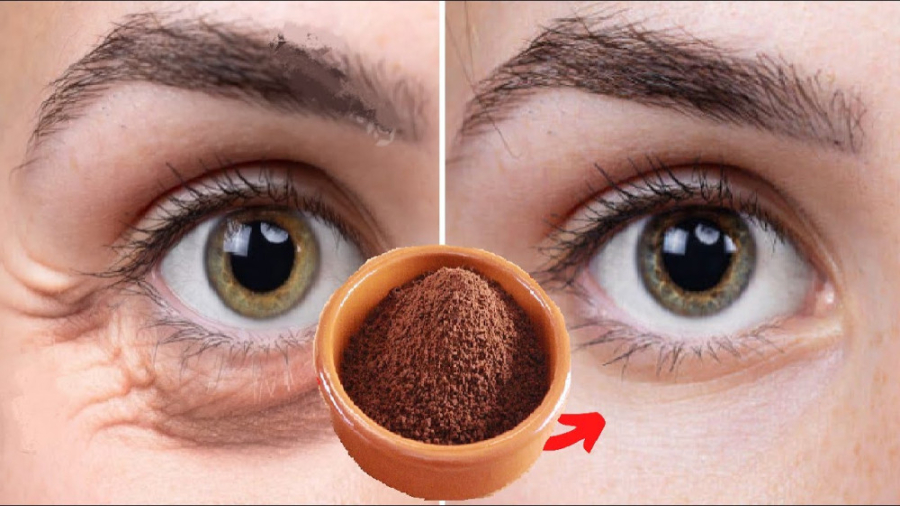 ماسک زیر چشم - جوانسازی پوست - سیاهی زیر چشم - روش ساخت ماسک ترمیم ونیر