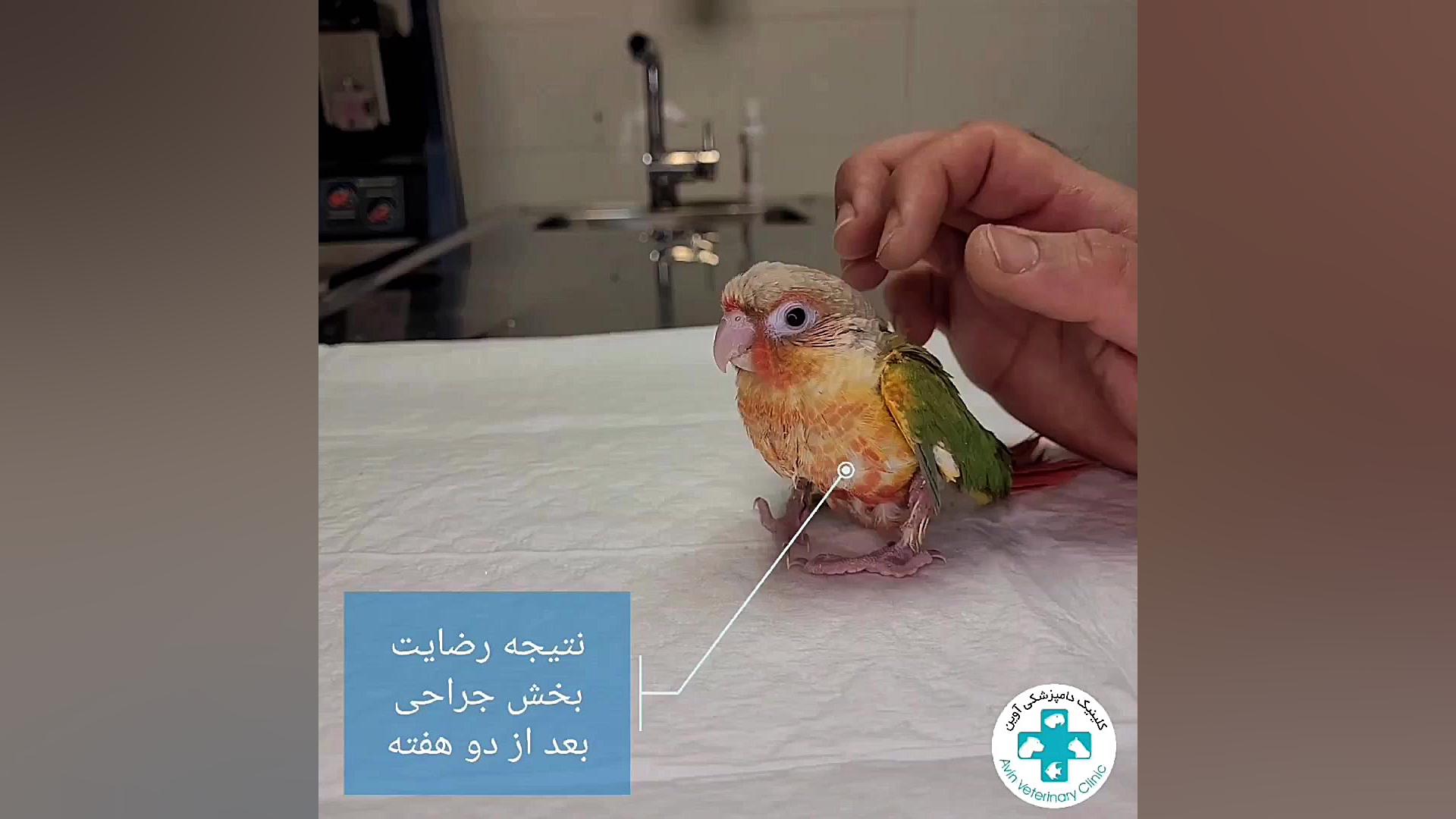 معجزه جراحی اصلاح زاویه پای گرینچیک بعد از دو هفته دکتر علی برهانی کیا