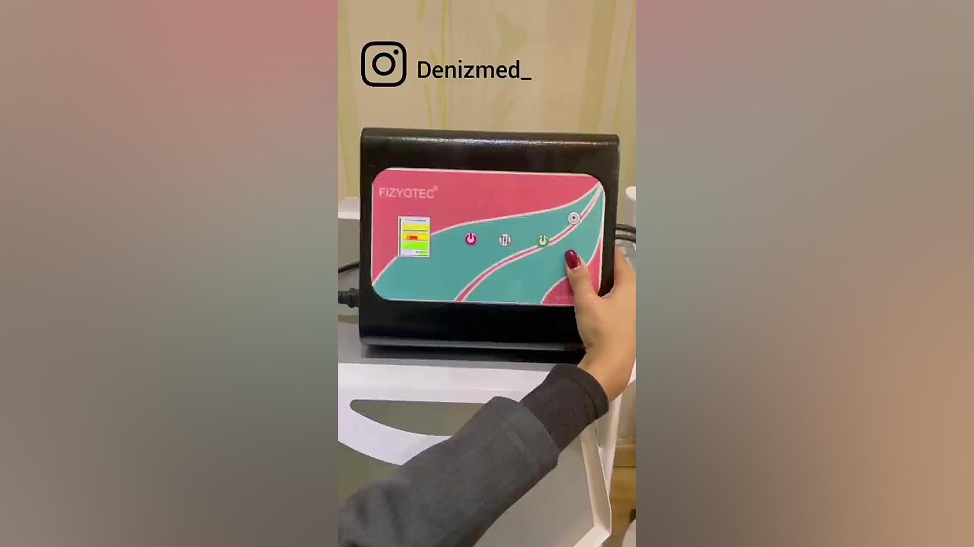 ترموکول 64 پالپوتومی