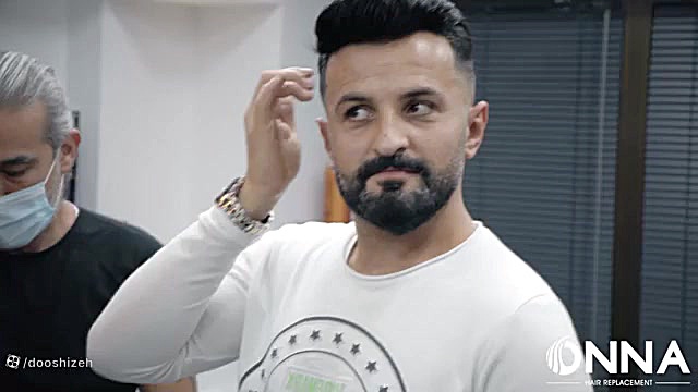 اکستنشن مردانه مو 09198858620 لیپوساکشن