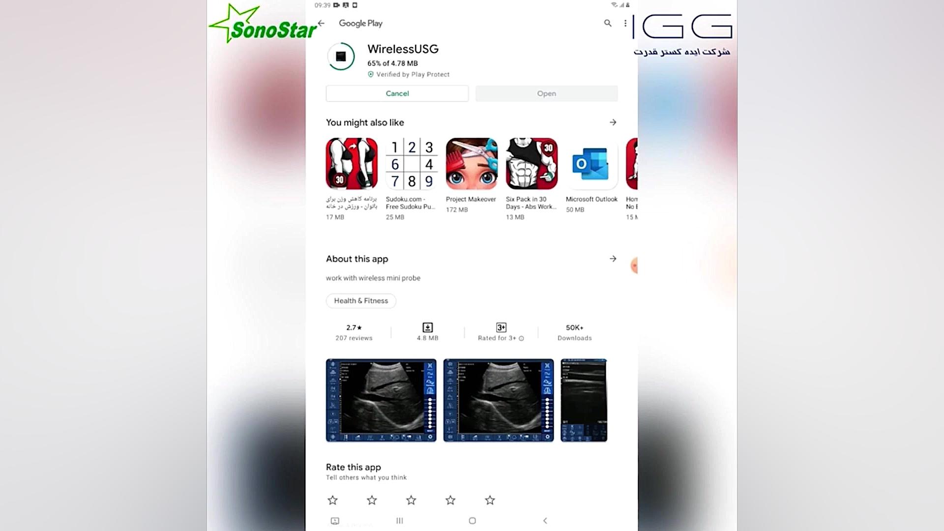 آموزش نصب نرم افزار سونوگرافی هندهلد برای android اتوپلاستی