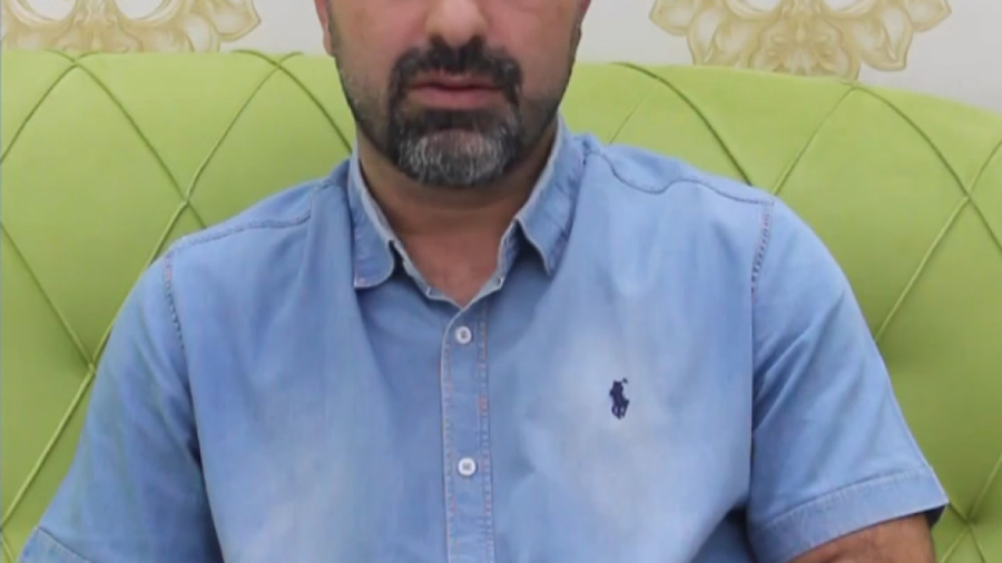 آنچه باید درباره بلیچینگ دندان بدانید رفع غبغب