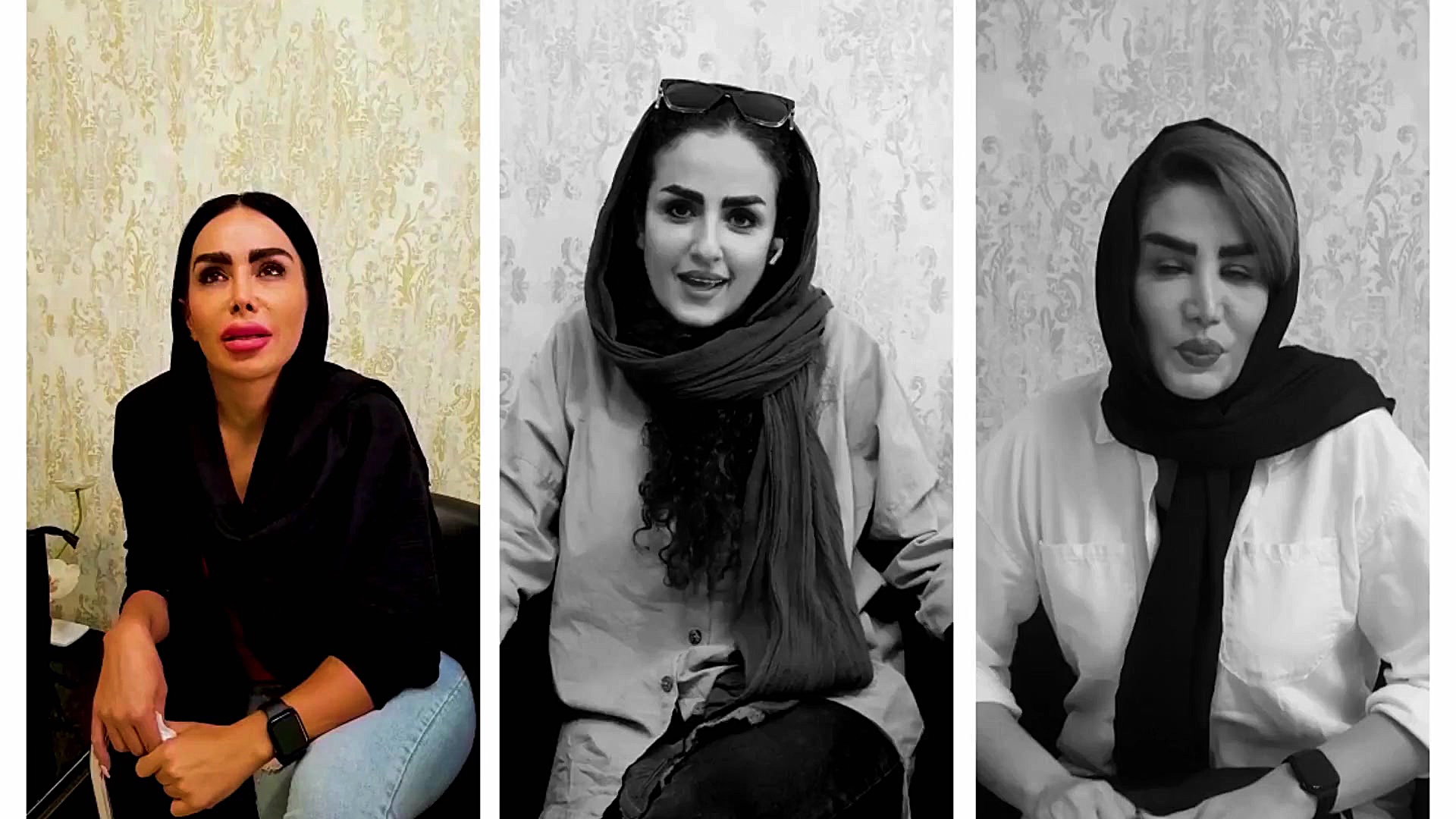 100 ها نمونه ی کاشت ابرو دکتر سمیه زمانی نیا بیماری گلوکوزامینوگلیکان تجمعی